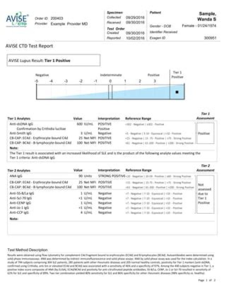 What is avise ctd test?
