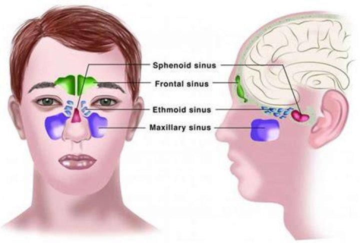 What is catarrhal inflammation?
