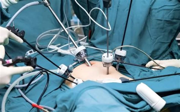 What is onco surgery?