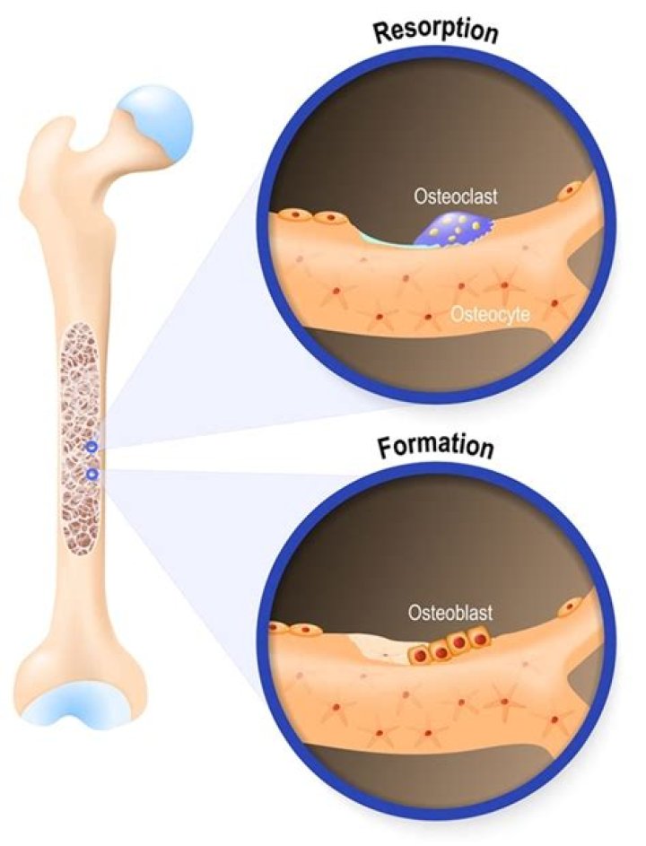 What is osteoblastic activity?