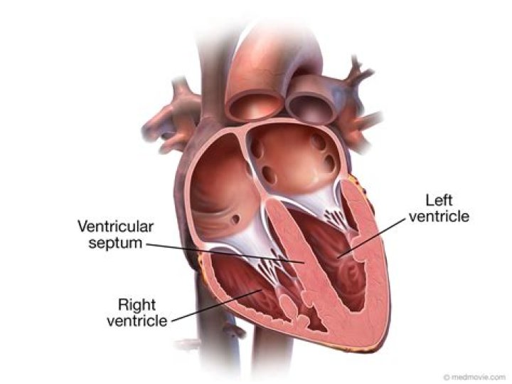 What is ventricle size?