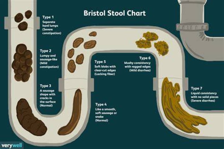 When a poop is too big?