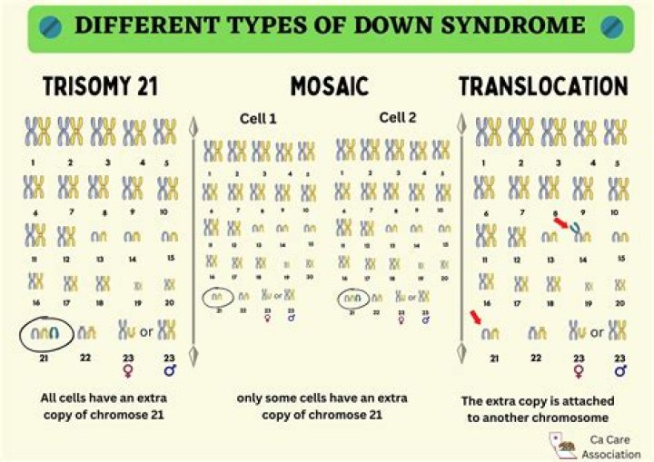 When do trisomies occur?