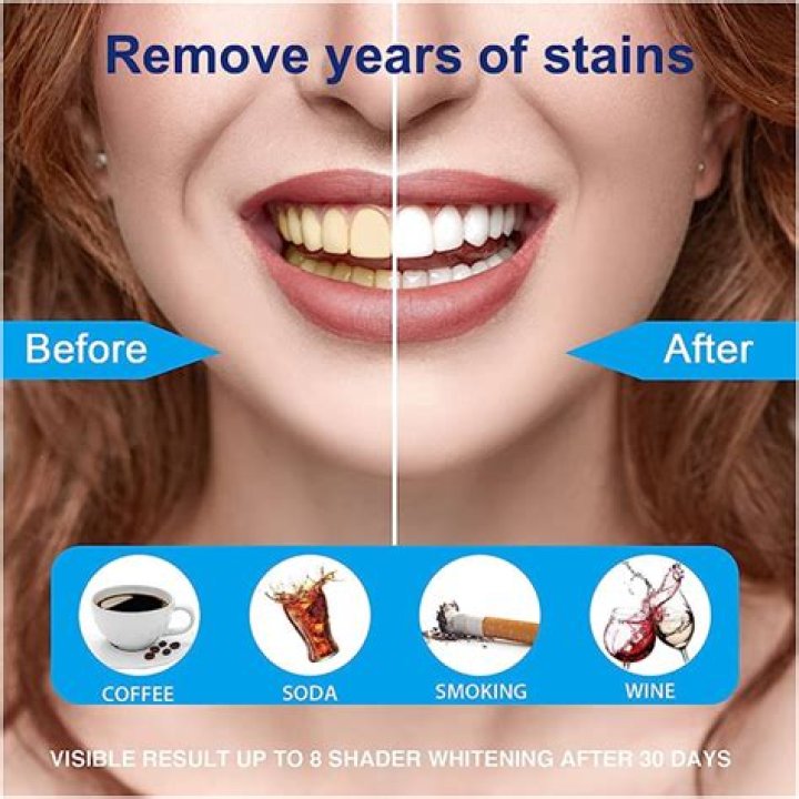When do whitening strips start to work?