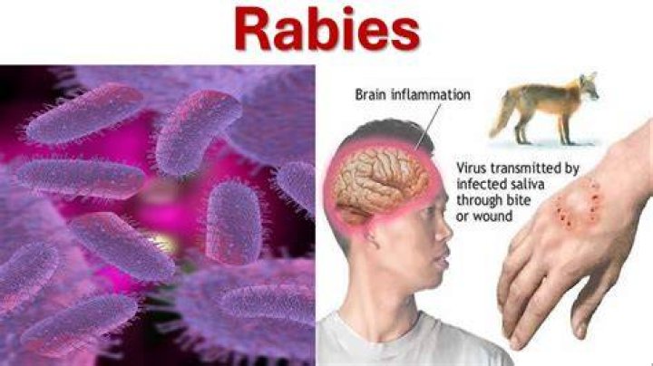 When do you get rabies?