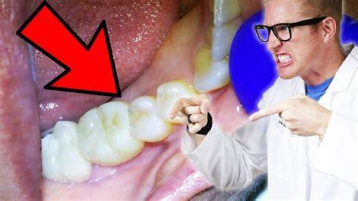 When i lay down my tooth throbs?
