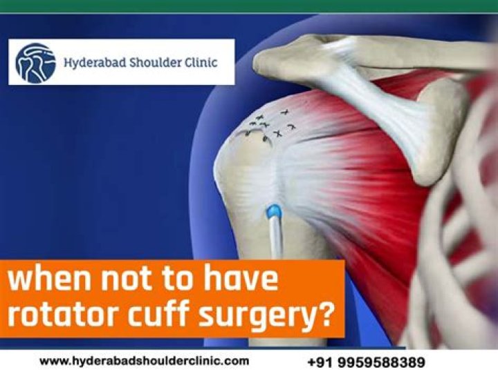 When not to have rotator cuff surgery?