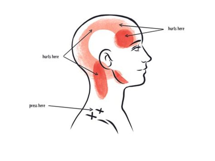 When stand up head throbs?