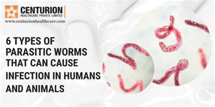 Where do roundworms live in humans?