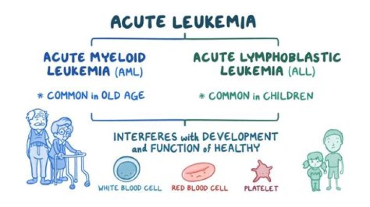 Where does acute lymphoblastic leukemia come from?