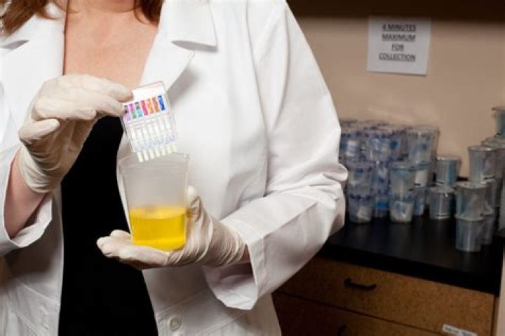 Where does concentra send urine tests?