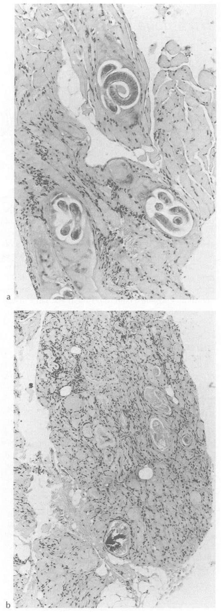Where does trichinella live?