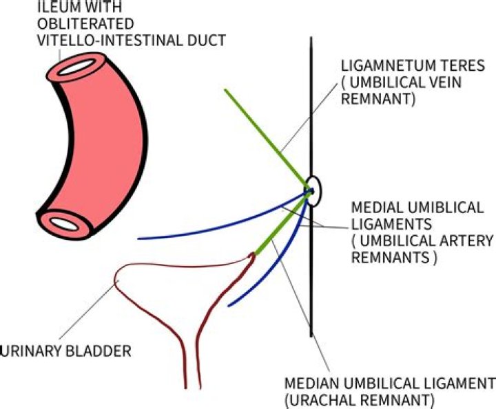 Where is the urachal sinus?