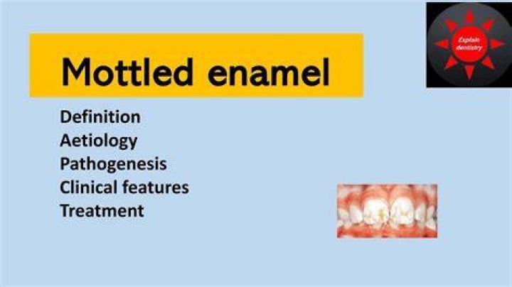 Who discovered mottled enamel?