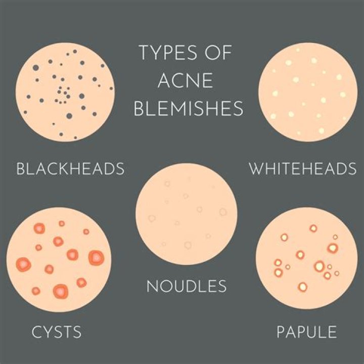 Who does blemish mean?