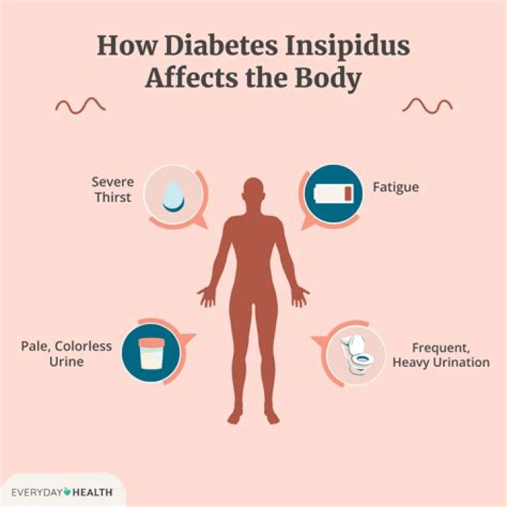 Who does diabetes insipidus affect?