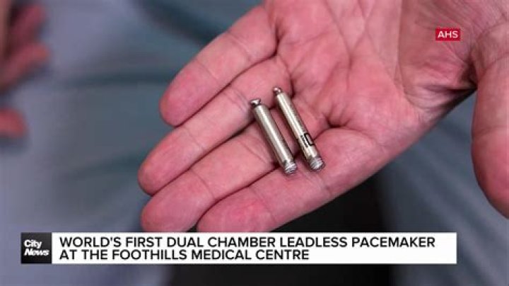 Who needs dual chamber pacemaker?