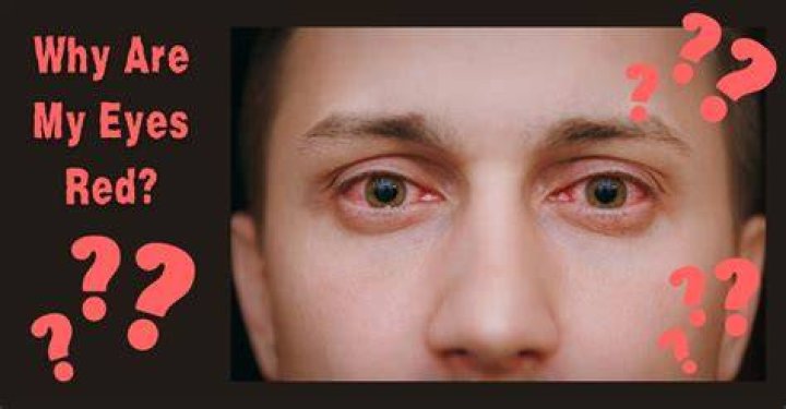 Why are moops eyes red?