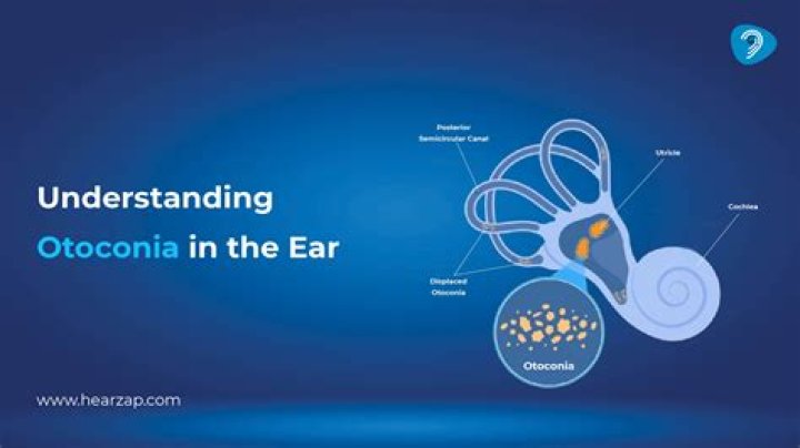 Why are otoconia important?