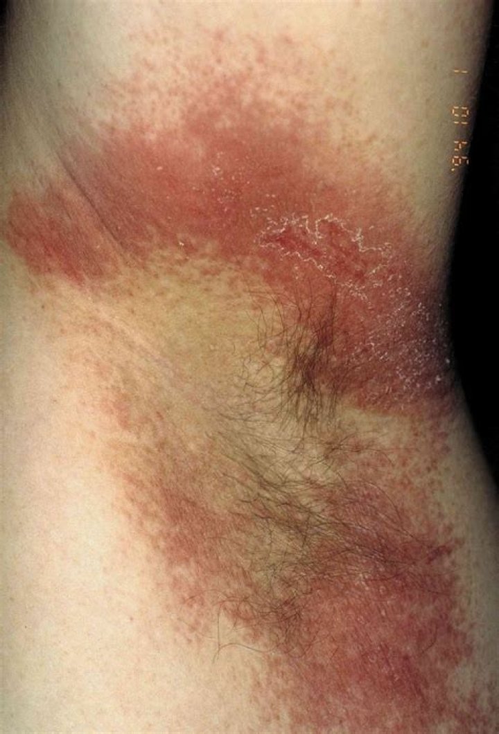 Why do my underarms hurt?