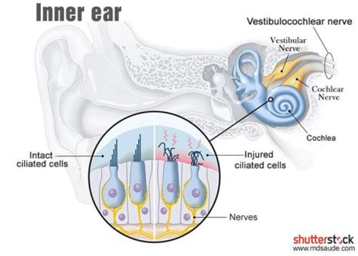 Why do your ears ring?