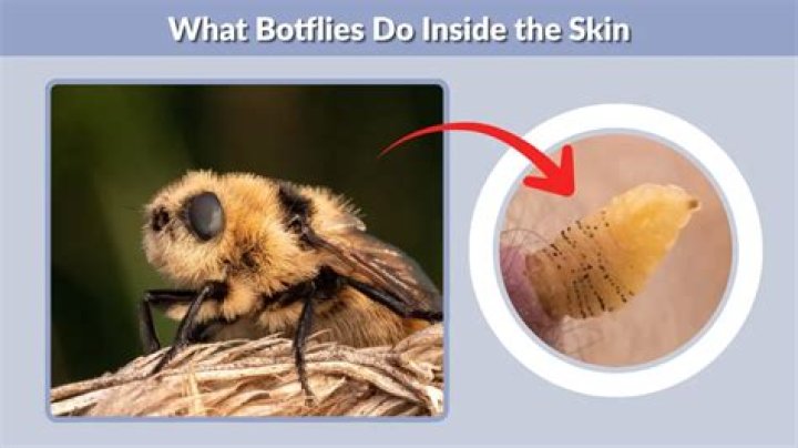Why does a botfly get inside you?