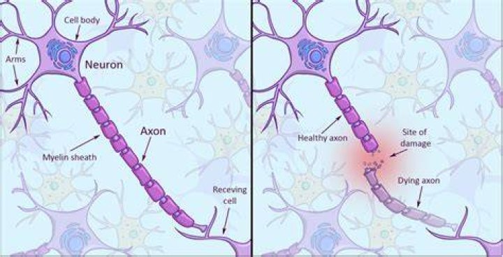 Why does cns not regenerate?