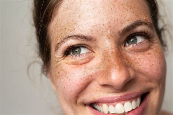 Why does my freckle hurt?