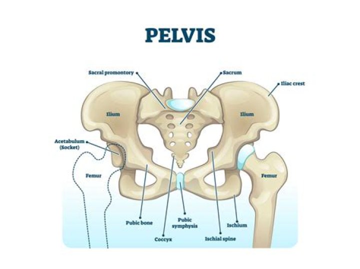 Why does my ischium hurt?