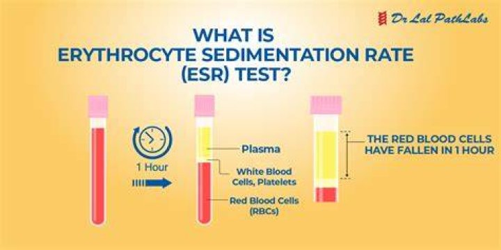 Why erythrocyte sedimentation rate increases?