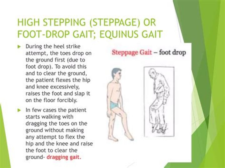Why high stepping gait?
