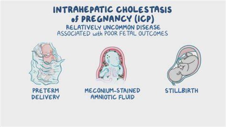 Why obstetric cholestasis occurs?