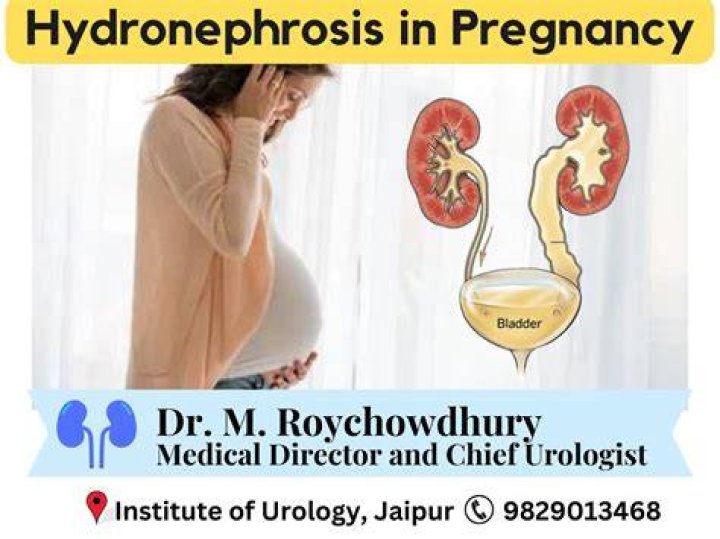 Why right hydronephrosis in pregnancy?