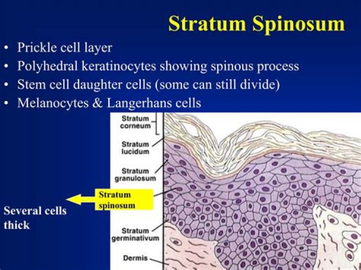 Why stratum spinosum called prickle cells?