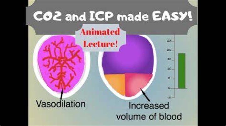Will carbon dioxide cause vasodilation?