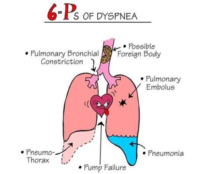 Will dyspnea go away?