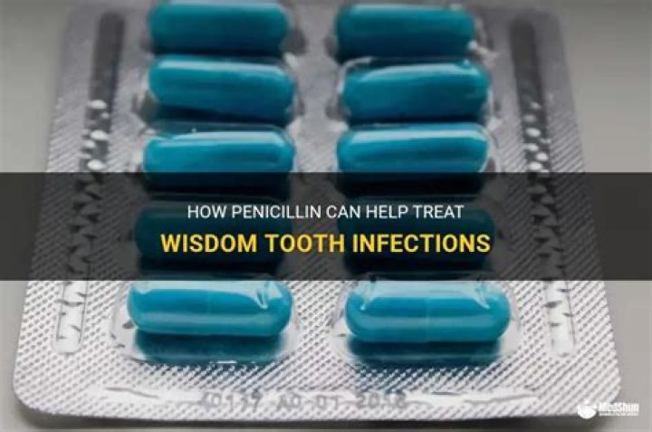 Will penicillin help a tooth infection?